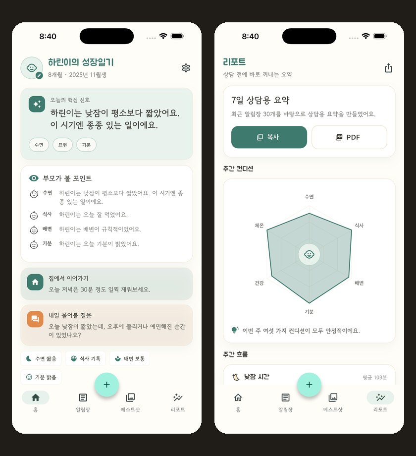 아이로그 앱 화면 — 오늘의 핵심 신호와 주간 리포트